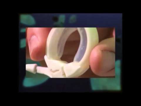 Segíts magadon - Elhízás, gyomorgyűrű 2/2