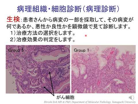 【山口大学OC2025／医学部／医学科】分子病理学講座紹介