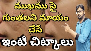 HOW TO REMOVE HOLES ON FACE NATURALLY AT HOME|How to remove pimple holes from face naturally at home
