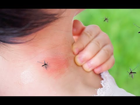 USA Deadly Mosquito borne virus on the rise no cure for humans Breaking News 2019 Video
