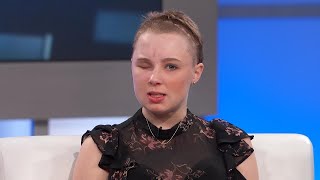 Woman on Attacker: He Has No Remorse for What He's Done