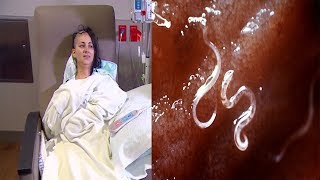 She Battled Severe Headaches for Almost a Year Then Doctors Took a Brain Scan and Saw Eight Eggs