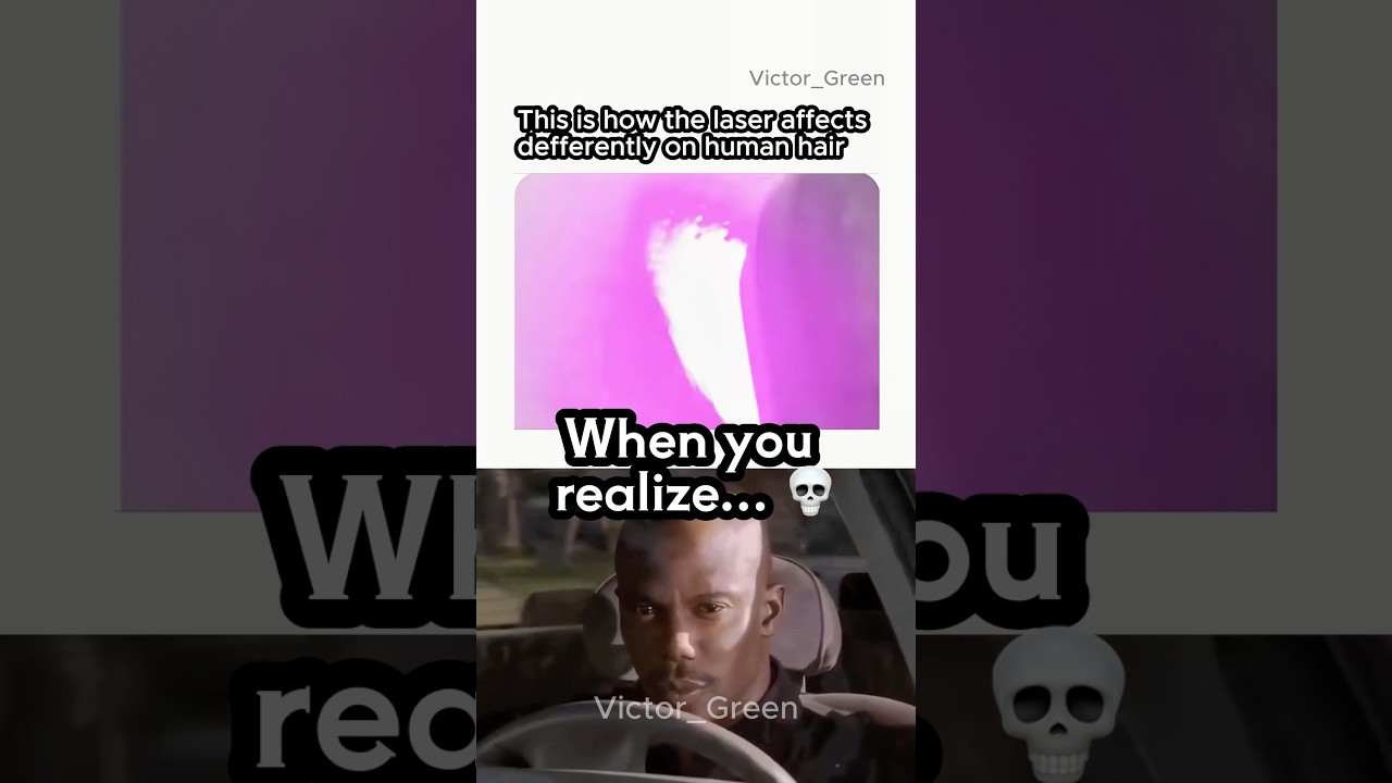 What THE LASER just did?!💀😭