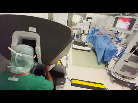 Remotely controlled inside the patient's abdomen - surgery with the Da Vinci robot