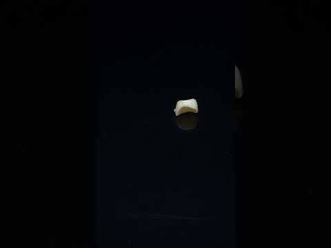 YouTube 썸네일
