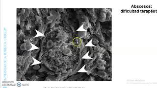 Infecciones de piel y tejidos blandos. Aspectos microbiológicos - BCP