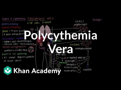 What is polycythemia vera? | Hematologic System Diseases | NCLEX-RN | Khan Academy