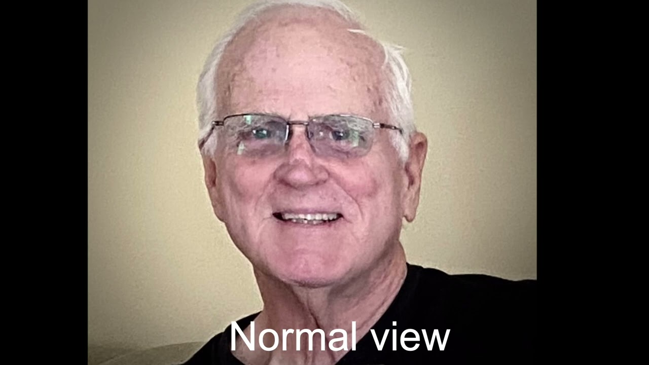 My Journey With Macular Degeneration