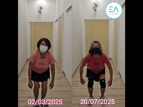 Knee PRP - Before & After