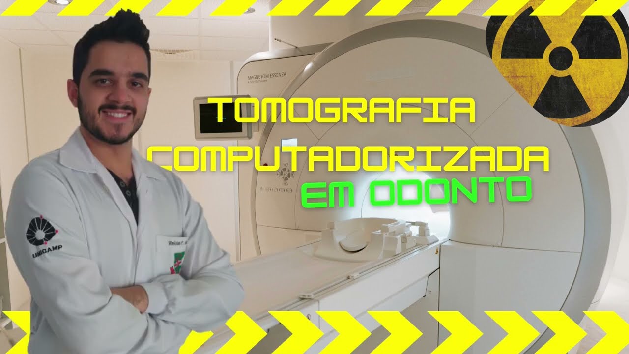 Tomografia Computadorizada de Feixe Conico (TCFC) Cone Beam