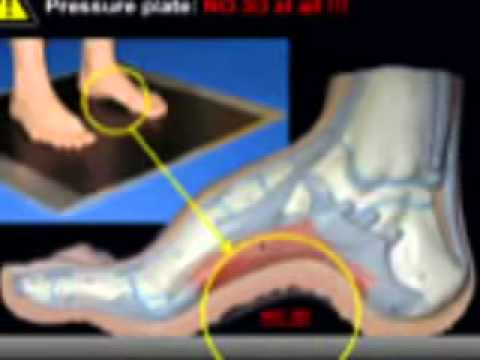 Recensioni osteocondrosi laser Se una joint fa male durante la notte