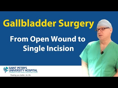 Gallbladder Surgery:  From Open Wound to Single Incision