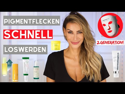 So wirst Du Pigmentflecken schnell los!!