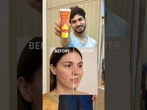 Vicco Turmeric Sandalwood Cream Review | Natural Skin Glow?