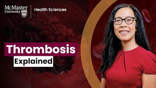 What you need to know about thrombosis