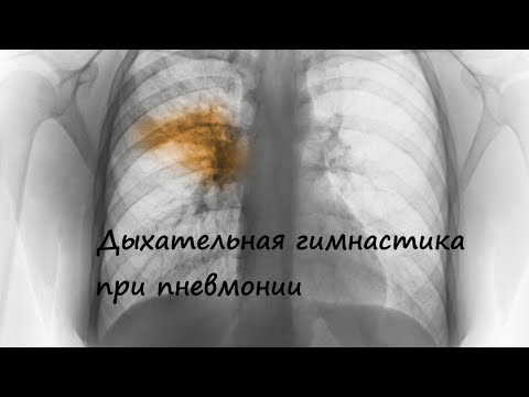 Дыхательная гимнастика при пневмонии (воспалении легких)