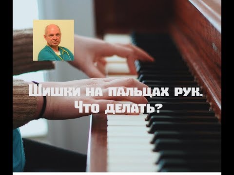 Шишки на пальцах рук. Что делать?#шишкинапальцах