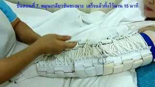 วิธีขันชะเนาะลดบวมที่แขน (Twisting Tourniquet Technique for Lymphedema in the Upper Extremity)
