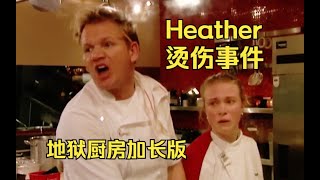 [問卦] 戈登燙傷處理先沖熱水！？