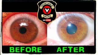 How to change your eye color naturally at home to blue. Iridology basics explained