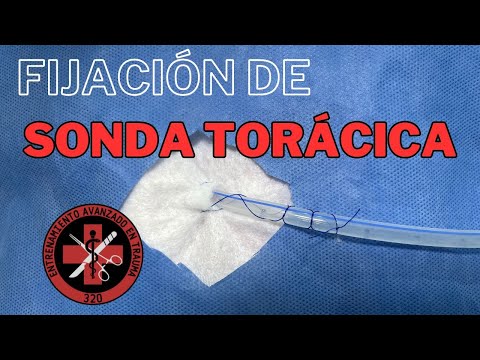 Nudo para fijación de sonda de toracostomía