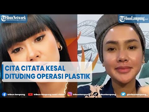 Singer Cita Citata Annoyed by Plastic Surgery Accusations @TribunLampungOfficial