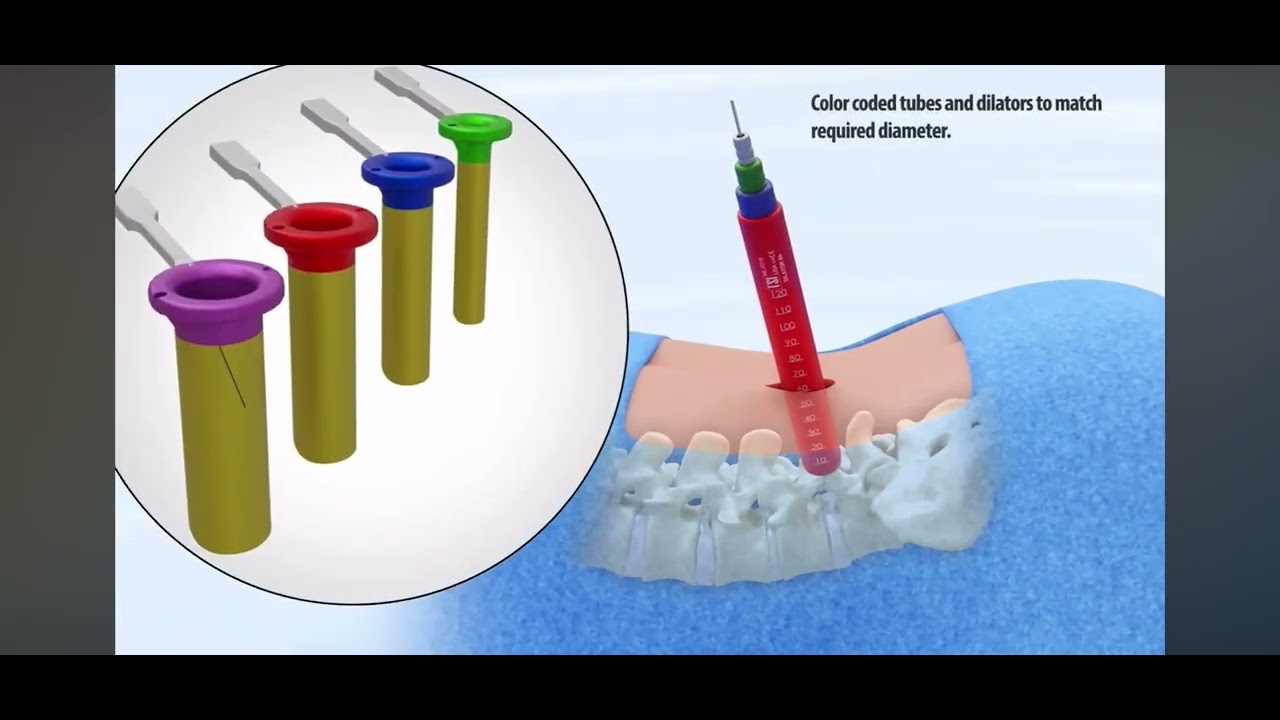 Valente Fragoza Padilla-20