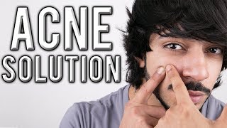 THE BEST ACNE TREATMENT | AESTHETICALLY