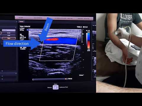 Color Doppler Made Easy -Part 2 -Practice
