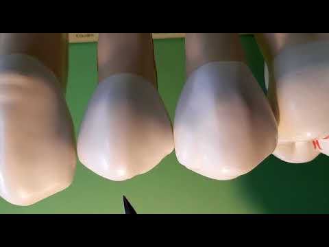 Zahnmerkmale OK Zaehne