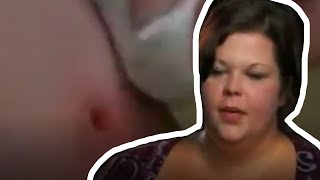 Women Can&#39;t Stop Picking Her Scabs