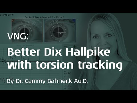 VNG: Improve Dix-Hallpike Maneuver Accuracy with 3D Eye Movement Recordings