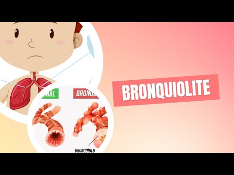 Bronquiolite Enfermagem Educacional