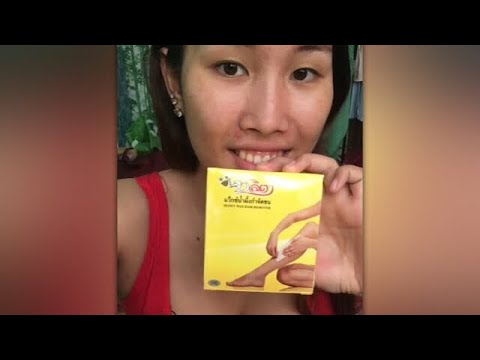 ยาเสพติดใหม่จาก neurodermatitis โรคสะเก็ดเงิน glucocorticosteroid ครีม