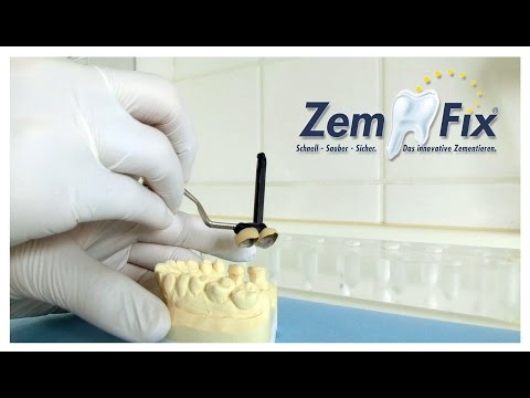Noch nie war es so einfach! 2 Kronen (VMK) gleichzeitig einsetzen mit ZemFix®