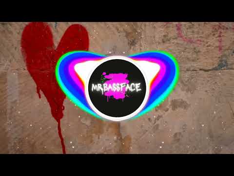 Mr Bassface - "Heartbroken"  (VOCAL VIP)