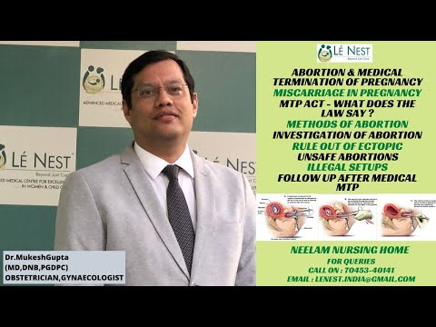 YouTube video about: How much do abortions cost in az?
