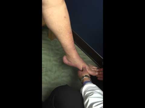 Anterior Tibialis Tendon Injury - MidAmerica Orthopaedics