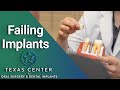 Reasons Dental Implants Fail
