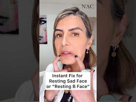 #daobotox #restingsadface #restingbface #botox #filler #drbitafarrell