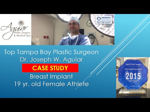 breast implant surgery fl ebony mom fucking boyfriend