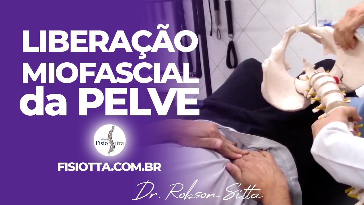 LIBERAÇÃO MIOFASCIAL PÉLVICA PUBEÍTE PUBALGIA DOR no PÚBIS Clínica de Fisioterapia Dr Robson Sitta