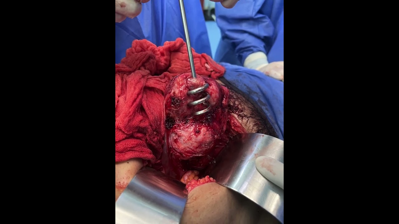 Ángel Millán Juárez-72