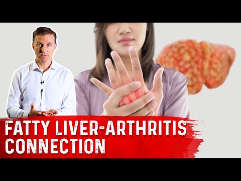 How Your Feet Are Warning You About Your Liver Problems Dr Berg Explains