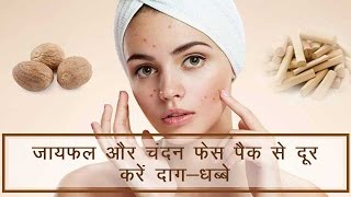Nutmeg and Sandalwood Face Pack to Treat Scars in Hindi | जायफल और चंदन फेस पैक से दूर करें दाग-धब्बे