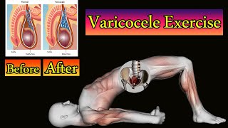 Download lagu Kegel Exercise for Varicocele with Photo mp3