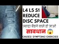 L4-L5 and L5-S1 reduced disc space exercises in Hindi | Disc space narrowing L5-S1 treatment