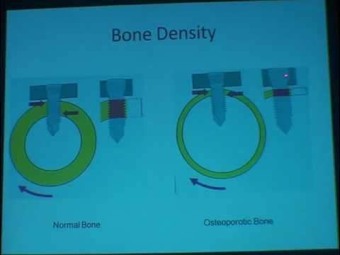 Periprosthetic Fractures IN TKA (TTT algorithm) Prof.D.Wael Nassar