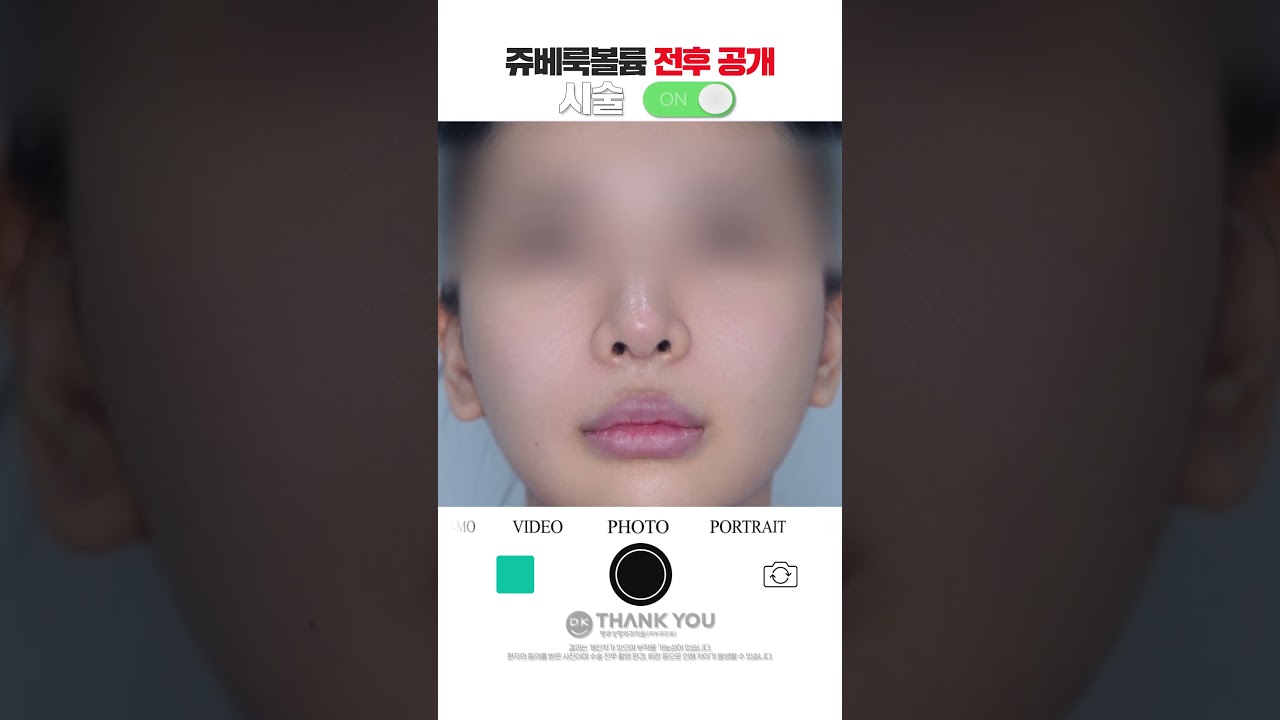 땡큐성형외과 Clips