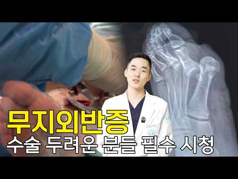 흉터 걱정 끝! 걷는 통증까지 해결하는 4세대 무지외반증 수술'의 모든 ..